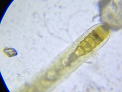 Fischerella