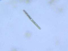 Haplotaenium minutum