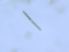 Haplotaenium minutum