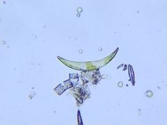 Closterium lunula