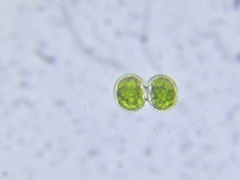 Cosmarium contractum