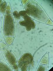 Bactridium ellisii