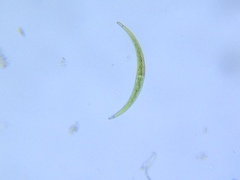 Closterium lunula