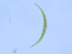 Closterium lunula