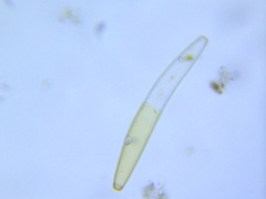 Closterium baillyanum