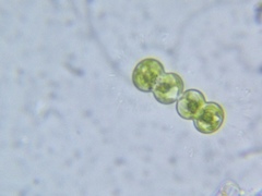 Cosmarium contractum