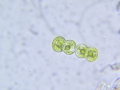 Cosmarium contractum