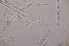 Bryoscyphus rhytidiadelphi