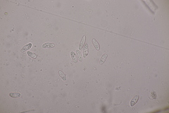 Bryoscyphus rhytidiadelphi