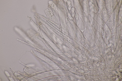 Bryoscyphus rhytidiadelphi