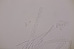 Bryoscyphus rhytidiadelphi