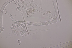 Bryoscyphus rhytidiadelphi