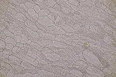 Bryoscyphus rhytidiadelphi