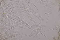 Bryoscyphus rhytidiadelphi