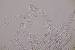 Bryoscyphus rhytidiadelphi