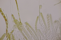 Bryoscyphus rhytidiadelphi