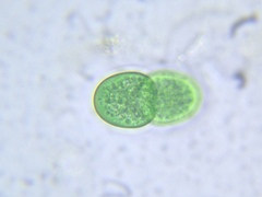 Cyanothece aeruginosa