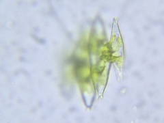 Micrasterias pinnatifida