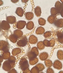 Fossombronia wondraczekii