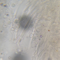 Rigidoporus ulmarius