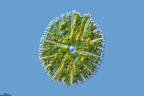 Micrasterias papillifera