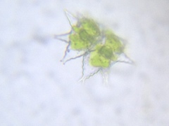 Staurastrum furcigerum