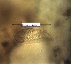 Blepharisma musculus
