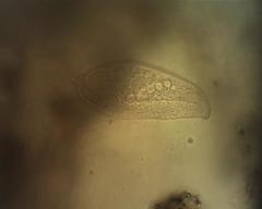 Blepharisma musculus