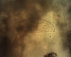 Blepharisma musculus
