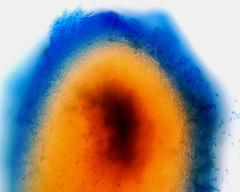 Chaenotheca brunneola