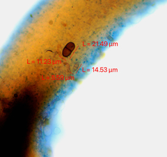 Chaenotheca brunneola