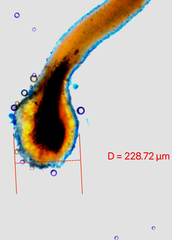 Chaenotheca brunneola