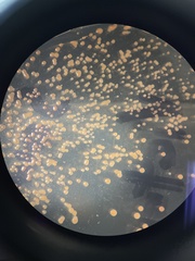 Saccharomyces cerevisiae