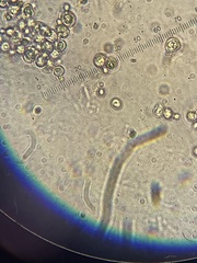 Saccharomyces cerevisiae