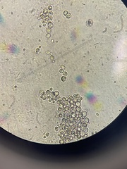 Saccharomyces cerevisiae