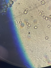 Saccharomyces cerevisiae