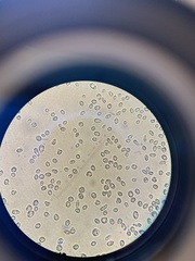 Saccharomyces