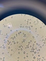 Saccharomyces