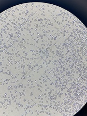 Saccharomyces