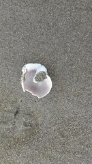 Semicassis centiquadrata