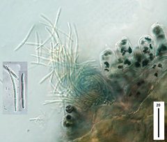 Sphaerulina westendorpii