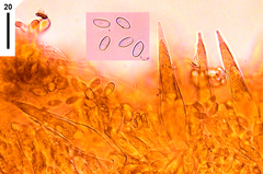 Macrocystidia