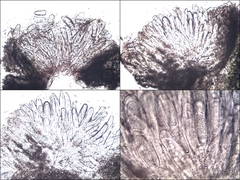 Pertusaria pustulata