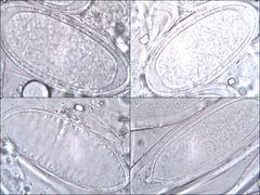 Pertusaria pustulata