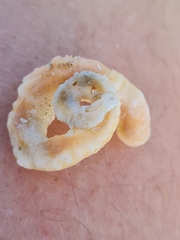 Thylacodes arenarius