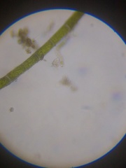 Strobilidium caudatum
