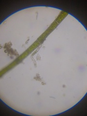 Strobilidium caudatum