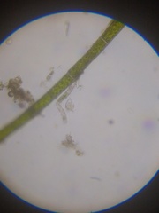 Strobilidium caudatum
