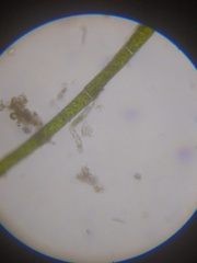 Strobilidium caudatum
