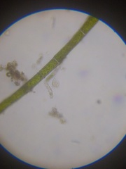 Strobilidium caudatum